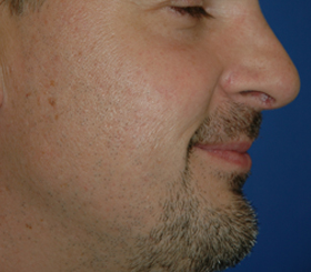 images/PatrickGarot-before.jpg