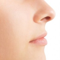 Lip Augmentation