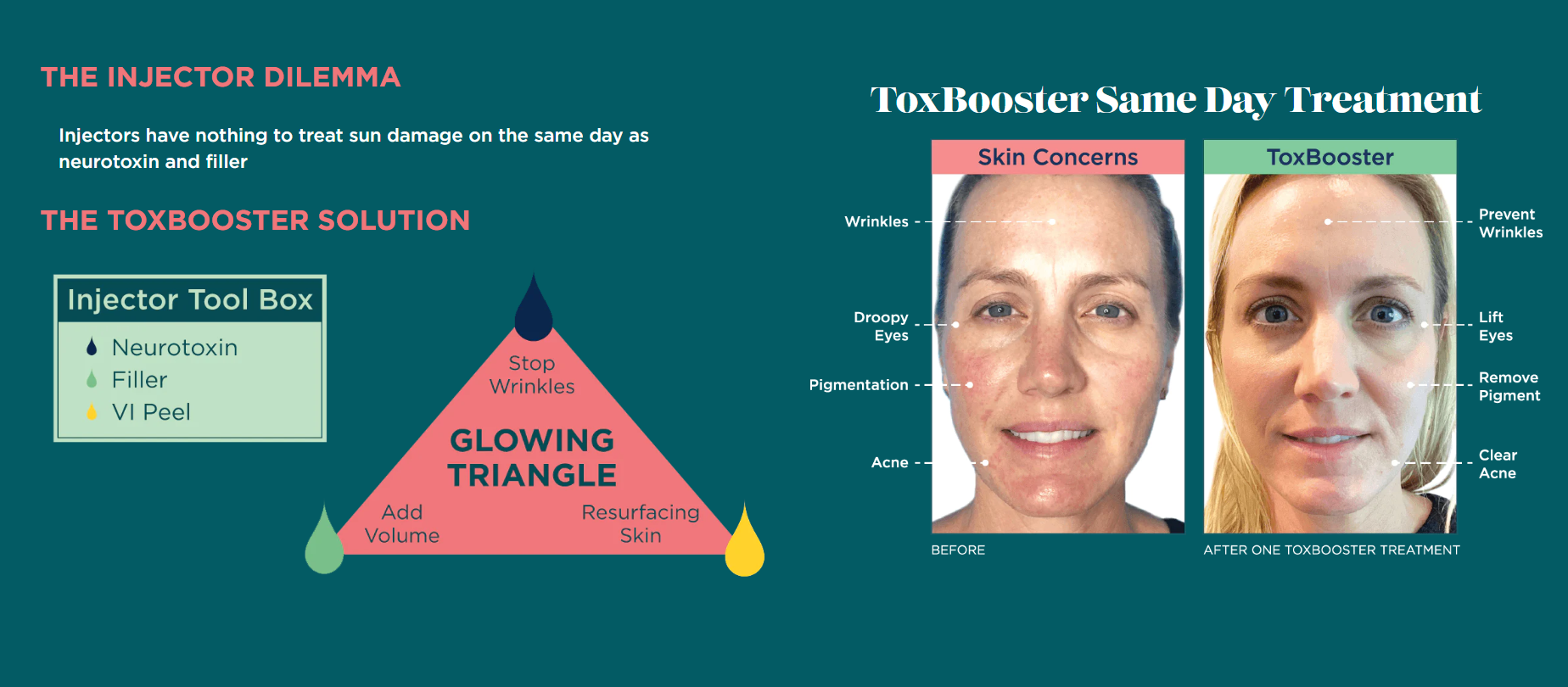 toxbooster san diego